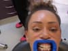 ‘It makes me so happy’: Mel B says after celebrity dentist transforms her smile with teeth whitening treatment