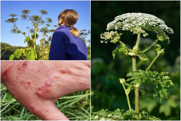 Warnings have been issued over the giant hogweed plant (Photos: Shutterstock)