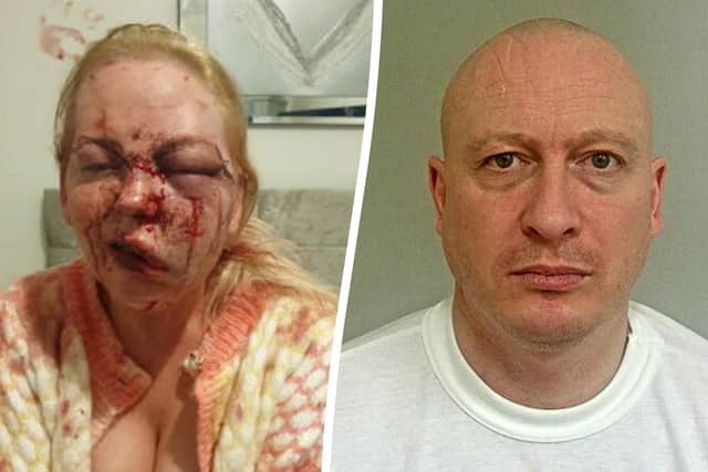 A mum beaten so badly by her violent partner that her face was left “unrecognisable” has shared a horrific picture of her injuries. The woman, who wishes to be anonymous, sustained a brain injury and a broken jaw after she was brutally attacked by Karl Machin, 44, who filmed the attack on his mobile phone.