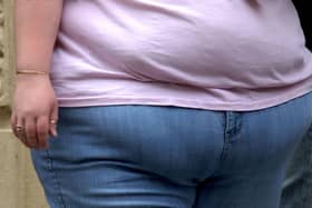 A meeting in Leeds has heard hundreds of people are now on a specialist waiting list for obesity problems.