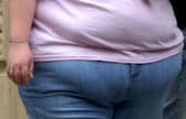A meeting in Leeds has heard hundreds of people are now on a specialist waiting list for obesity problems.