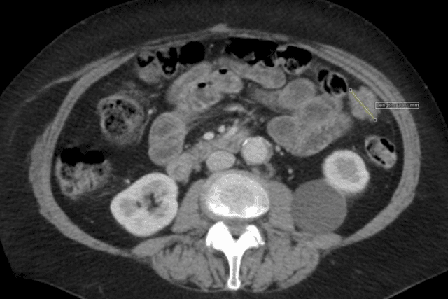 A law firm has argued that scan clearly showed the presence of cancer.
