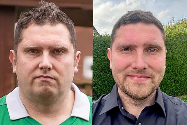 Mike Hirst, 40, before and after surgery. Photos: Mike Hirst