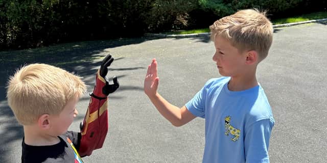 Boy, 5, rides scooter hours after being fitted with bionic arm.