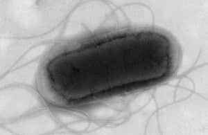 The UK Health Security Agency (UKHSA) has reported that an E. coli outbreak, suspected to be associated with a nationally distributed food item or several items.