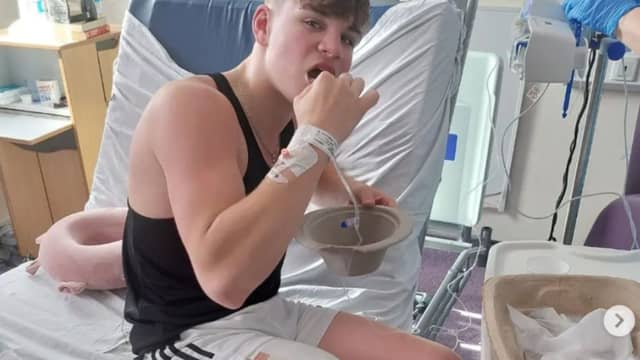 Ollie Hercombe, 16, snapped his leg spontaneously while sparring in a boxing gym and had to have his leg amputated.