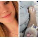 Gilana Milner, 19, was working in an animal rescue centre when dog Hugo lunged at her.
