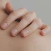 Could you tell the difference between a harmless rash from a fatal illness? (Photo: Pexel, Ximena Mora)