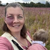 Frith Zerfahs, 44. A mum who wore make-up to "cover up" her birthmark for 20 years says having kids helped her "love" her difference as she didn't want to "hide" from them. 