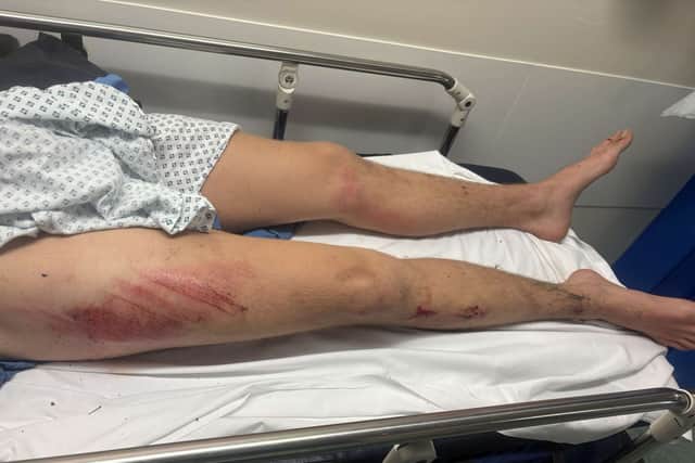 Marshall Hoyle in hospital