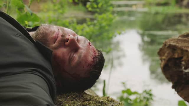 Aaron Dingle (DANNY MILLER) after his fall in Emmerdale