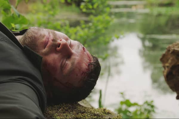 Aaron Dingle (DANNY MILLER) after his fall in Emmerdale