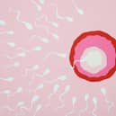 Being able to access NHS-funded IVF in the UK has been described as a "postcode lottery". 