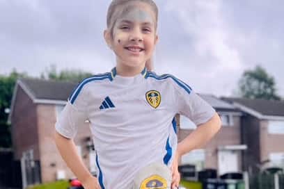 Katie in her Leeds United top with her stoma Diamond dressed to match