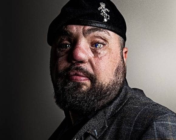 Simon Brown, Leeds city councillor and blind veteran