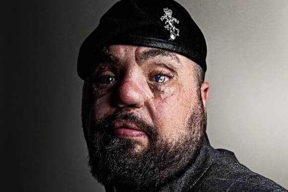 Simon Brown, Leeds city councillor and blind veteran