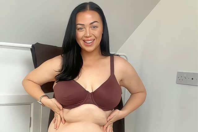 'It's beautiful' A mum who has struggled with an overhanging belly has told how she is now helping millions with their body image