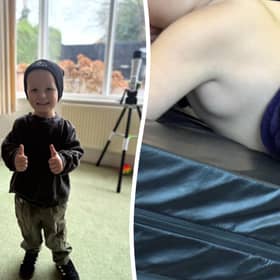 Charlie Shilleto is battling a rare form of cancer