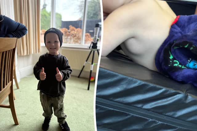 Charlie Shilleto is battling a rare form of cancer