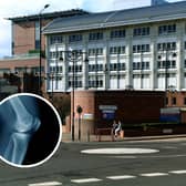 A shortage of bone cement has meant that some surgeries at hospitals in Leeds will be delayed.