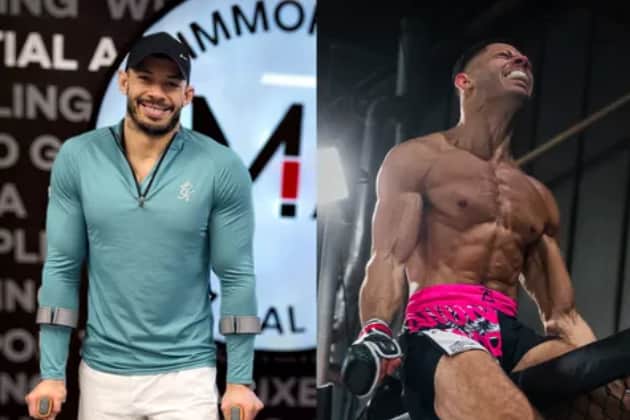 Despite suffering a horrific training injury, Leeds PT and MMA athlete Louis Baker is optimistic and reminds others to focus on their end goal.