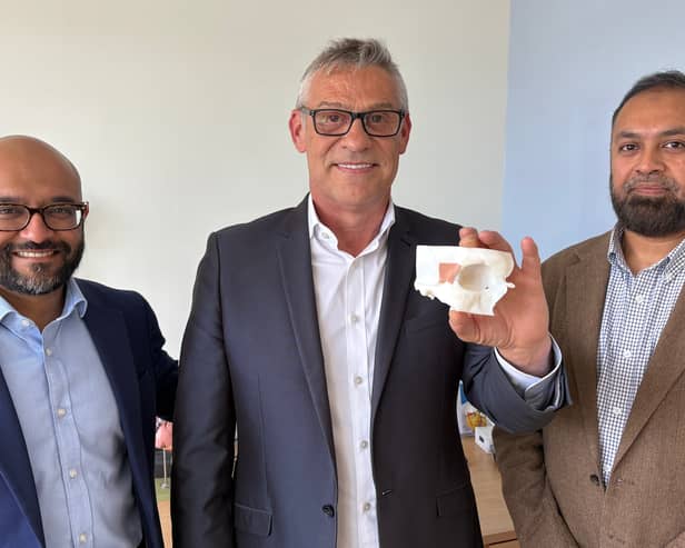 (left to right) Maxillofacial Surgeon Mr Jiten Parmar, patient Andrew Wood holding a bespoke 3D printed model of his eye socket, and Consultant neurosurgeon Asim Sheikh   at Leeds Teaching Hospitals NHS Trust