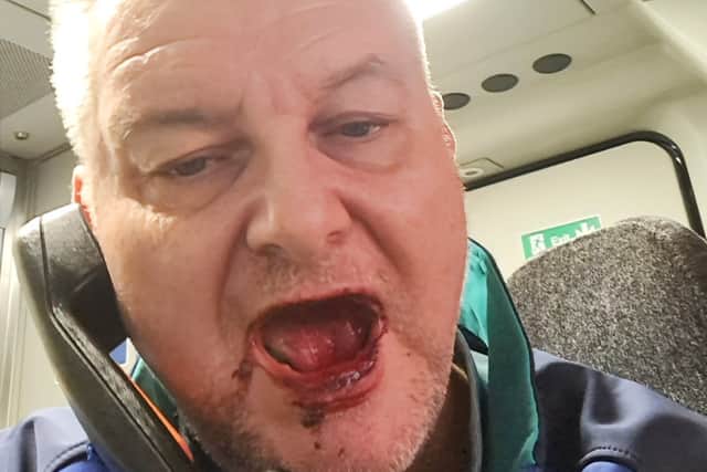 Peter Corley, after the attack.