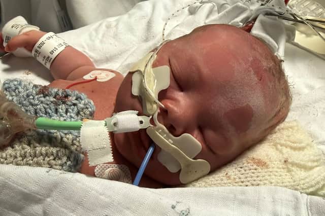 Zach Ince was cared for at Martin House Hospice after being taken into care at LGI shortly after his birth.
