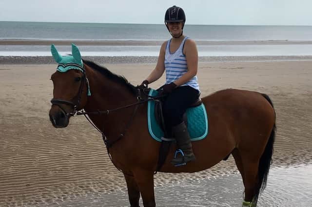 A woman from West Yorkshire says a surgical treatment for lymphoedema has been ‘life-
changing’ after two and a half years of living with the condition.
