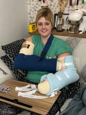 A woman from West Yorkshire says a surgical treatment for lymphoedema has been ‘life- changing’ after two and a half years of living with the condition.