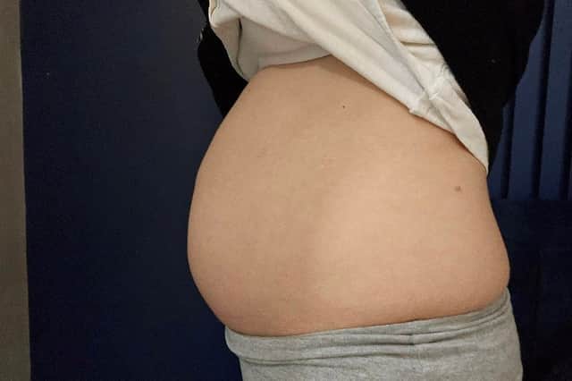 Rebecca Fargie's bloated stomach.