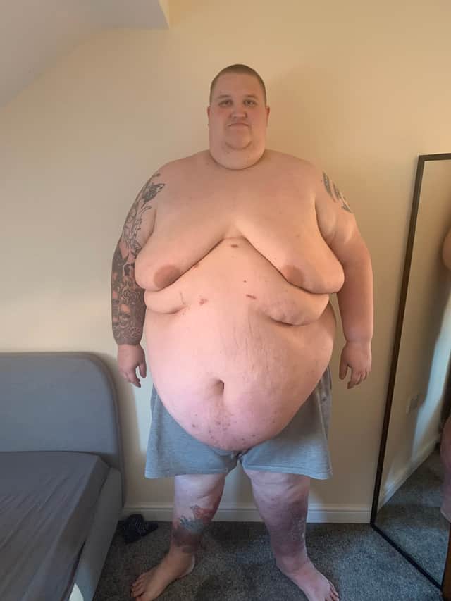 Jack weighed 47 stone at his heaviest.