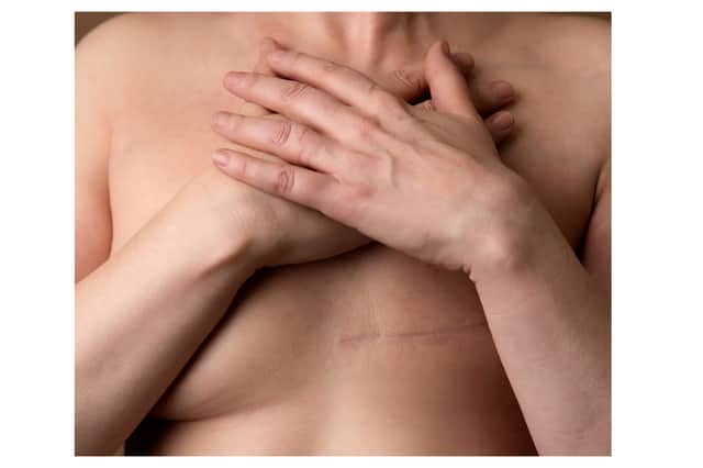 The magazine aims to tell women's breast cancer stories through their own words and pictures