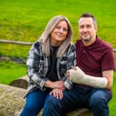 Dan Parry sliced his thumb off in a DIY accident but had it saved by surgeons at LGI.