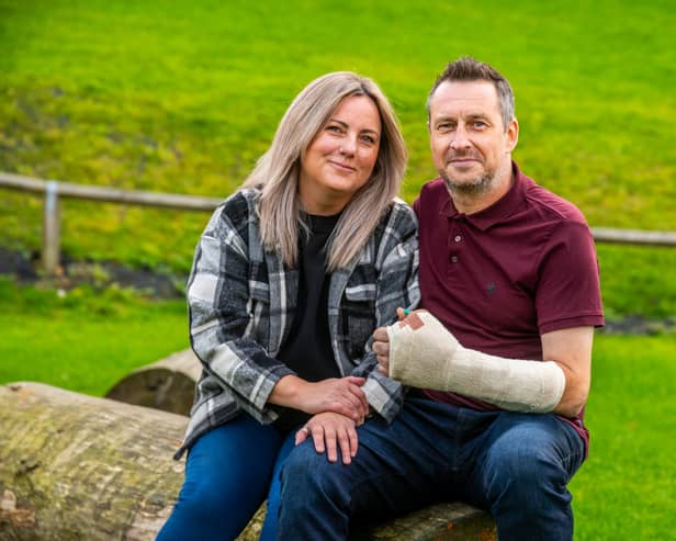 Dan Parry sliced his thumb off in a DIY accident but had it saved by surgeons at LGI.