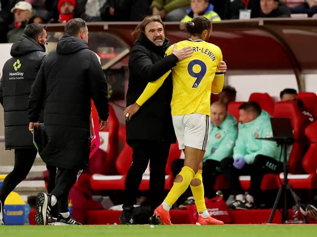 Calvert-Lewin was one of three Leeds doubts for Sunday's clash at Sunderland due to a bruised foot suffered in the previous weekend's 1-1 draw at home to Manchester United but the Whites no 9 started at the Stadium of Light and came through 85 minutes.