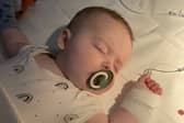 Rohan during treatment