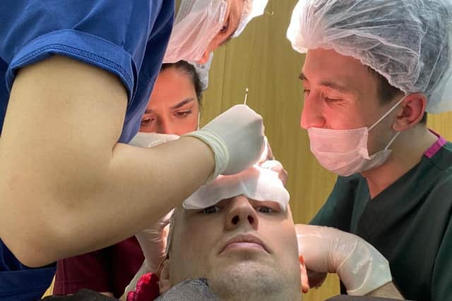 Former Leeds Rhinos player Shaun Lunt was back on the field three days after undergoing a seven hour hair transplant operation. Picture: Shaun Lunt/SWNS