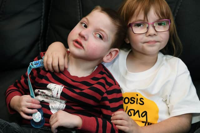 Abbie and her brother Oliver, three, both have cystic fibrosis