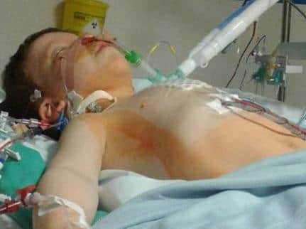 Ethan Blackburn, pictured during this recovery from his third open heart surgery.