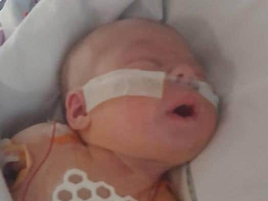 ImogenHoneybourne was just eight-days-old when she had heart surgery. Photo provided by family.