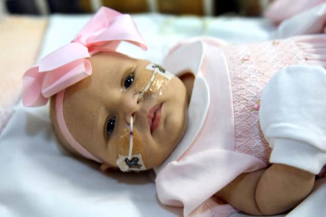 Little Arabella Irvine has a rare heart defect and is being treated in the Leeds Children's Hospital.
