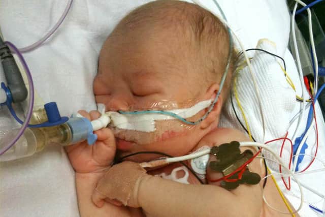Little Zane, pictured after his life-saving surgery at LGI's congenital heart unit.