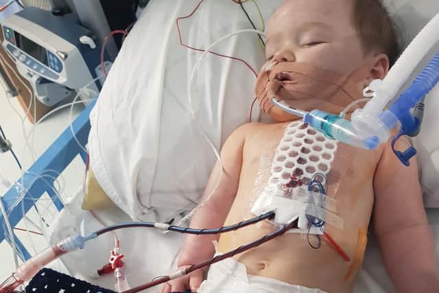 Roman Bullock, pictured after his second open-heart surgery at seven months old.