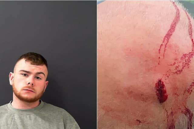 Billy Cooper, 22, of Highfield Road, Keighley was jailed after assaulting a police officer. Photo: North Yorkshire Police.