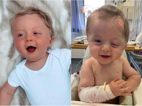Roux Owen celebrates his first birthday at Leeds General Infirmary on Thursday