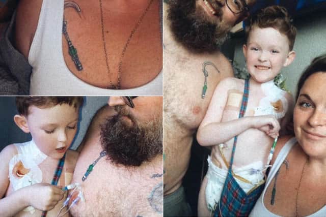 Michelle and Patrick's dad Peter got matching tattoos of the broviac central line on their chests - the tube on Patrick placed under the skin on the chest wall and into a large vein that leads to his heart.