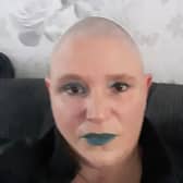 Donna Binns, from Garforth, shaved her hair to raise £1,000 for Macmillion Cancer support nurses.