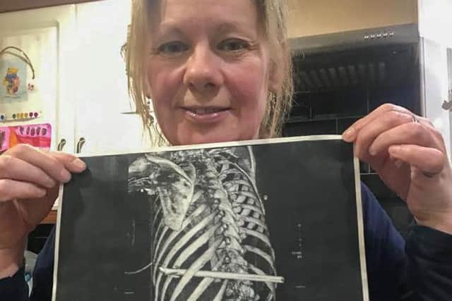 Sharon with a copy of her x-ray