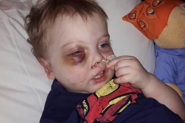 Riley Hoult pictured in hospital in February 2015.